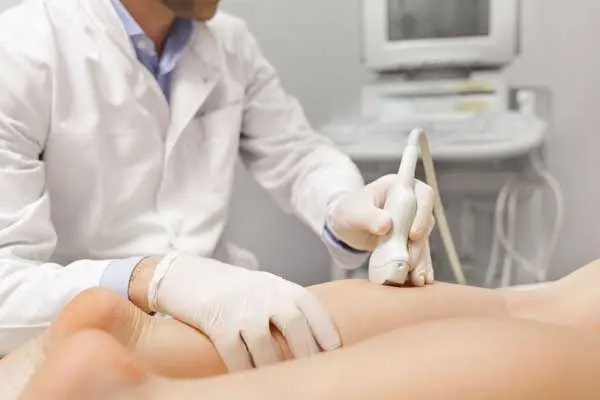 Ultrasound Guided Foam Sclerotherapy